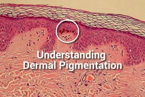 Understanding Dermal Pigmentation with pastiche training