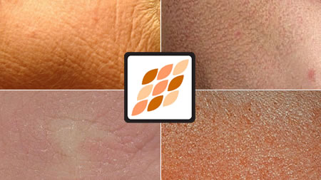 Advanced skin analysis course online from Pastiche.